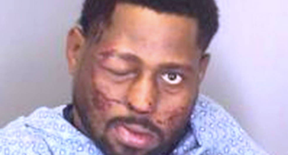 California clerk calls cops on black man who asked for refund — and he’s beaten to a pulp at jail
