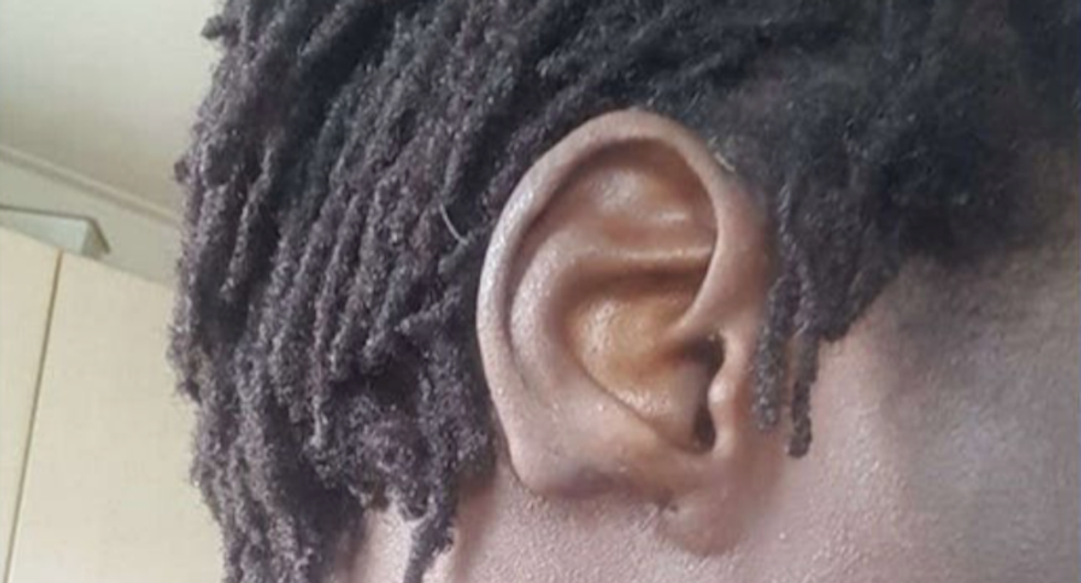 Gay man's family cut off his ear after he came out