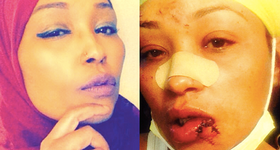Woman who smashed Muslim's face with Applebee's beer mug won't face hate crime charges -- here's why