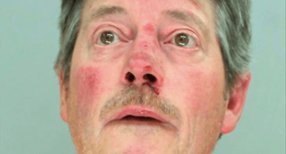 Minnesota man guns down worker at employees' holiday party and fights with arresting officers