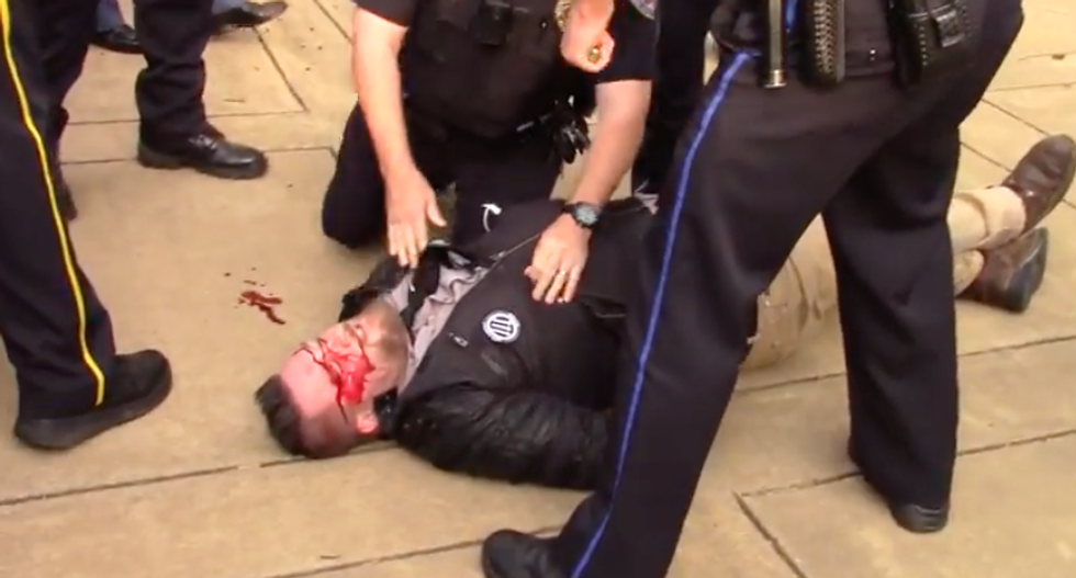 Activist bloodied in brawl at protest ahead of white supremacist's Auburn University speech