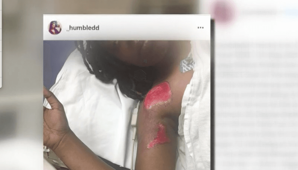 White racist hits black woman with his truck and drags body across the road -- police charge her with obstructing traffic