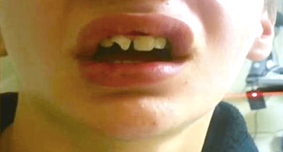 Idaho mom calls police to report she’d found her missing son — and cops come smash the boy’s face