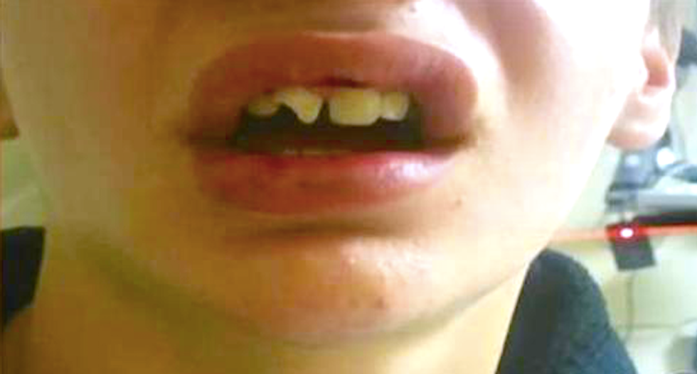 Idaho mom calls police to report she’d found her missing son — and cops come smash the boy’s face