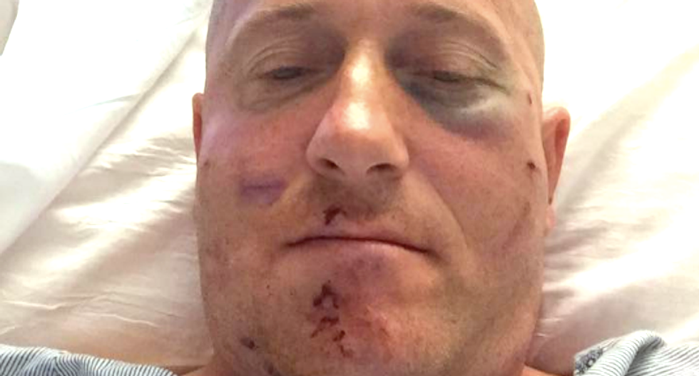 Political opponent pulverizes West Virginia Democrat's face with brass knuckles