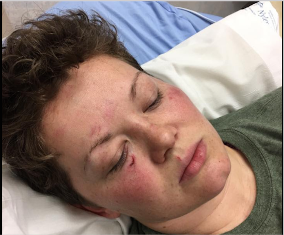 Kentucky woman says man beat her for looking too masculine -- as people stood by and watched