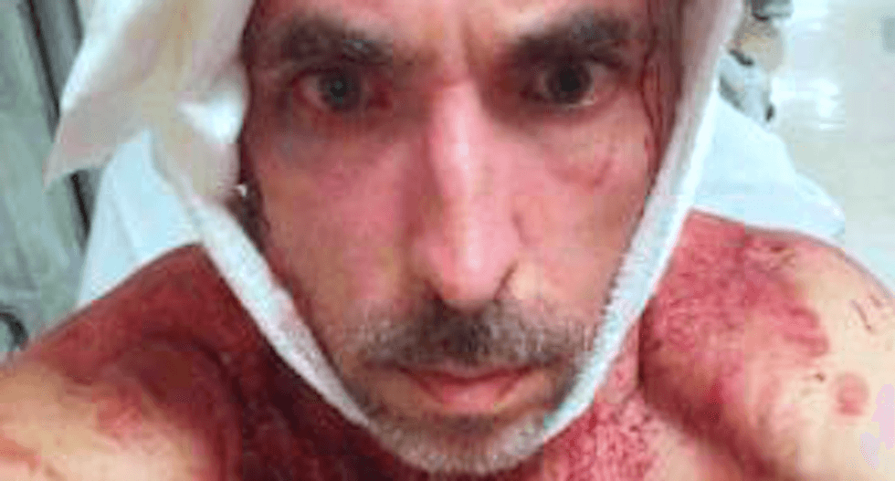 Trump fan known for ‘Pizzagate’ rants beaten up while trolling Philly impeachment rally