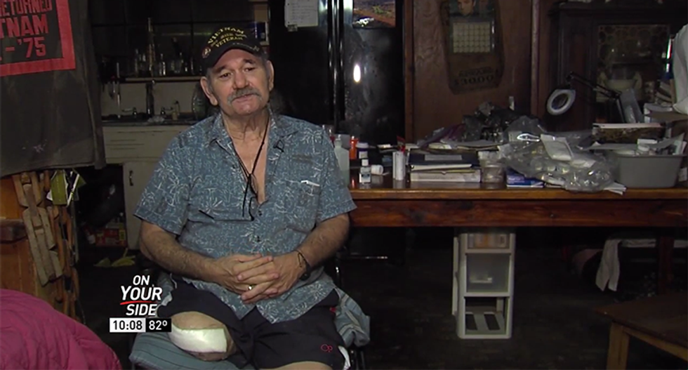 Opioid scare run amok: VA won’t buy pain medication for Vietnam vet after leg amputation