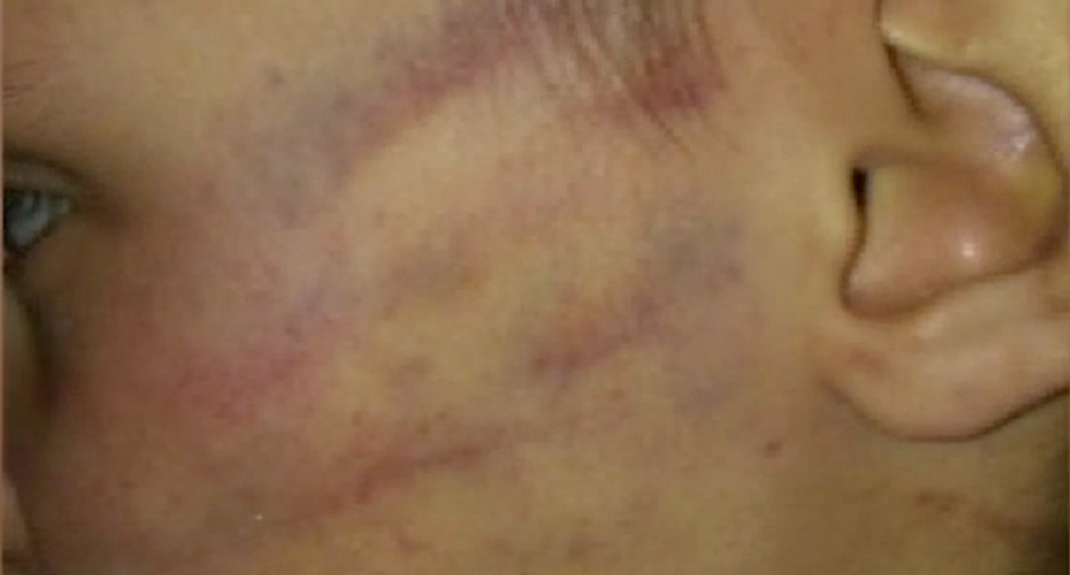 5-year-old Oklahoma boy beaten ‘to teach him a lesson’ about opening Christmas presents early: police