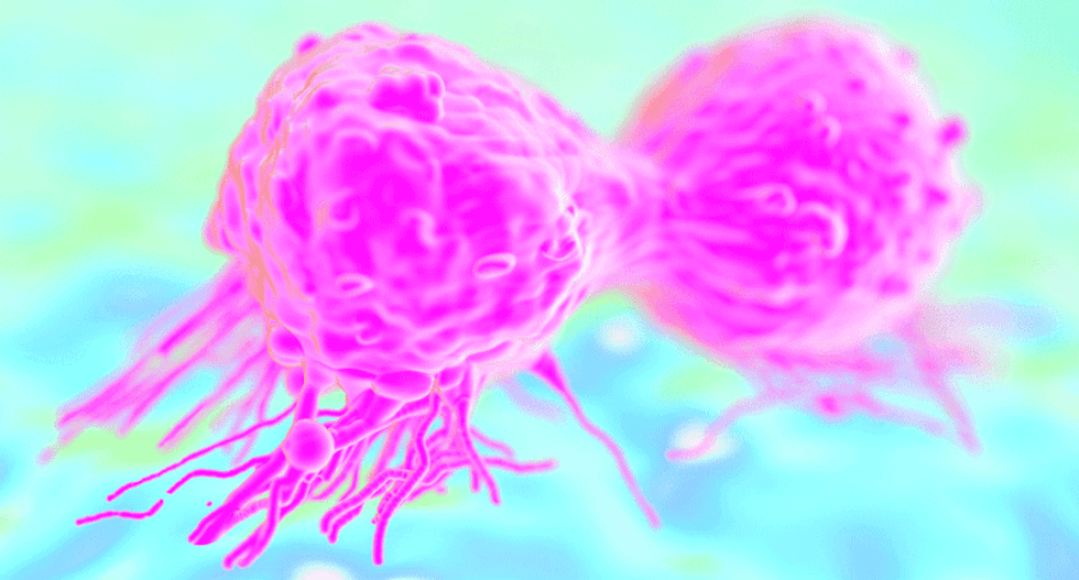 Cancer often due to bad luck, not genes or environment