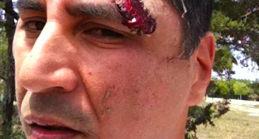 Texas dad left paralyzed when cops beat him 'like a bunch of thugs' after mistaking him for drug suspect