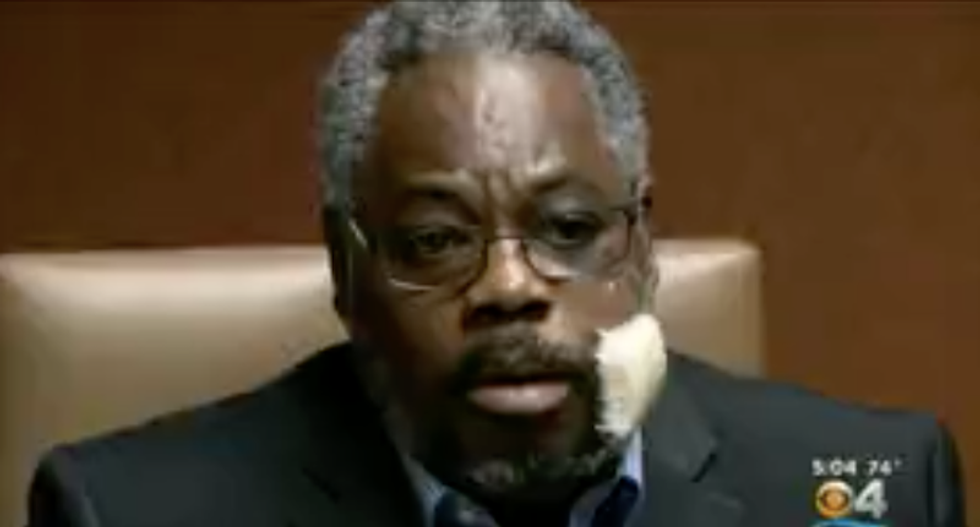 Black man stabbed in the face by supermarket employee after asking to use the bathroom