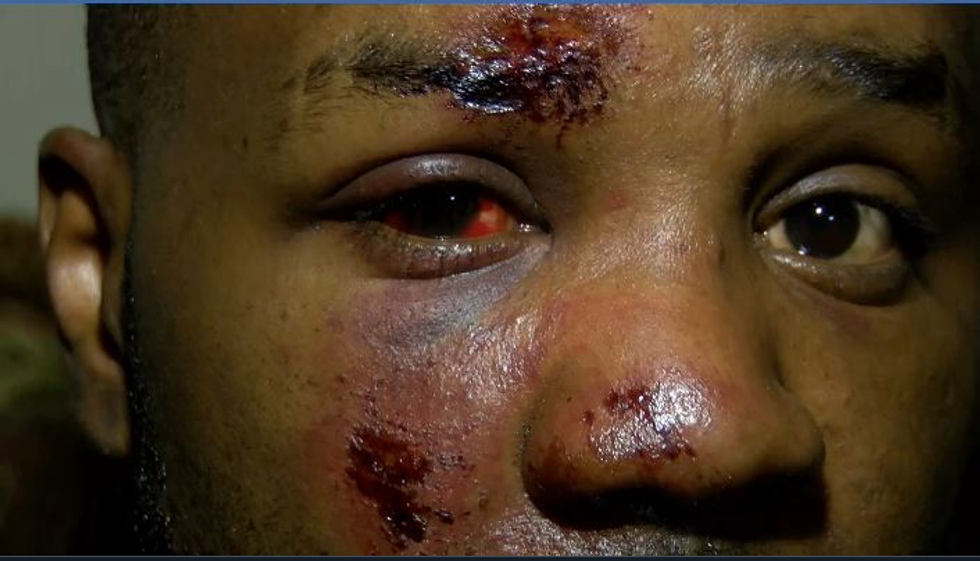 'I’ve never been so afraid': Black Mississippi man demands 'justice' action after being beaten by police