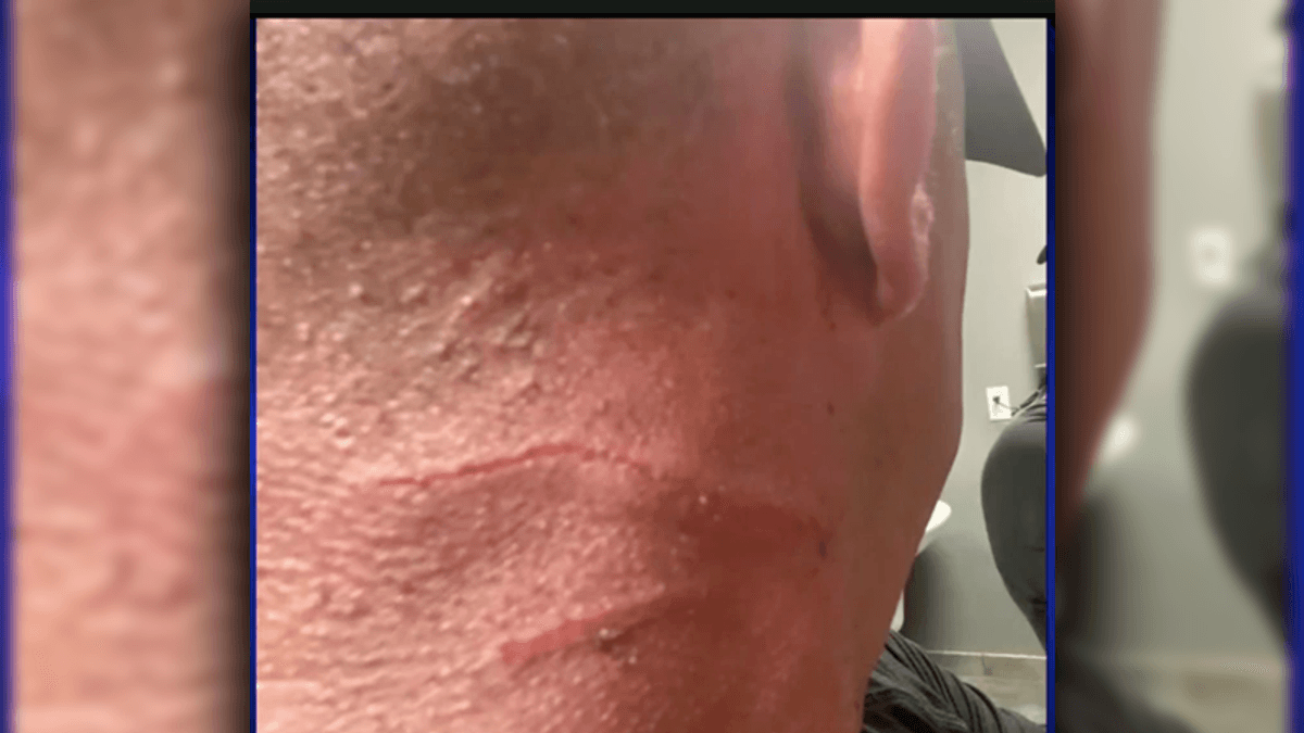Miami women slash man after he claimed Ron DeSantis said he didn't have to wear a mask