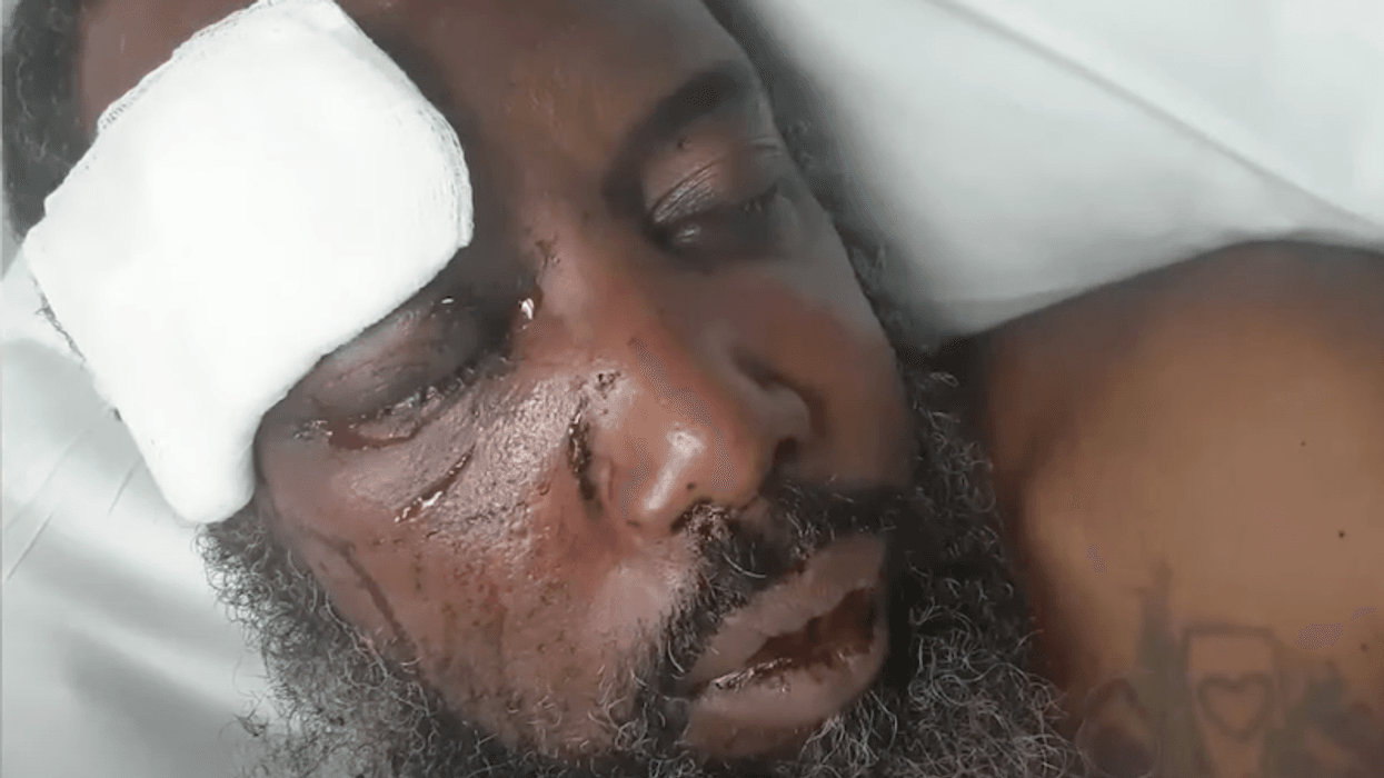 Black cyclist brutally assaulted by slur-spewing suspect who said he was 'making people nervous': report