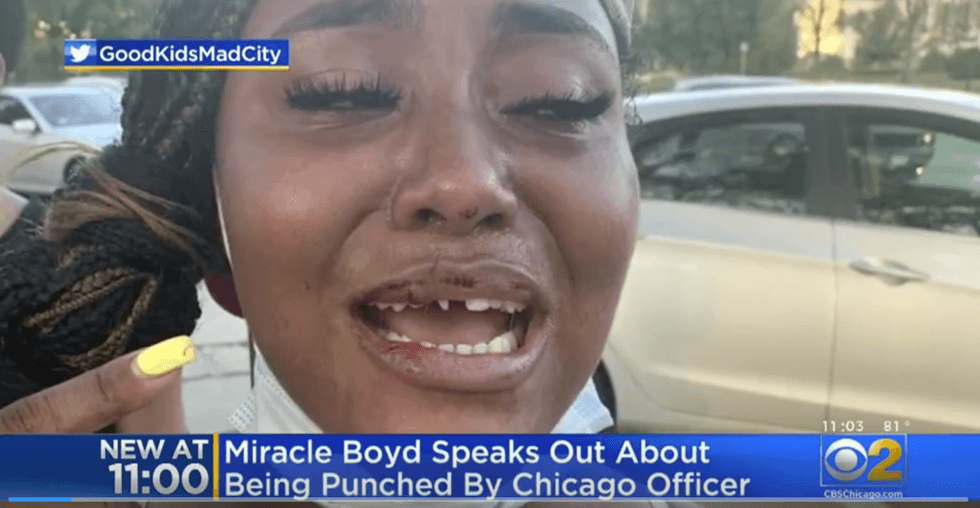 New bodycam video shows Chicago cop slugging social justice activist in the face