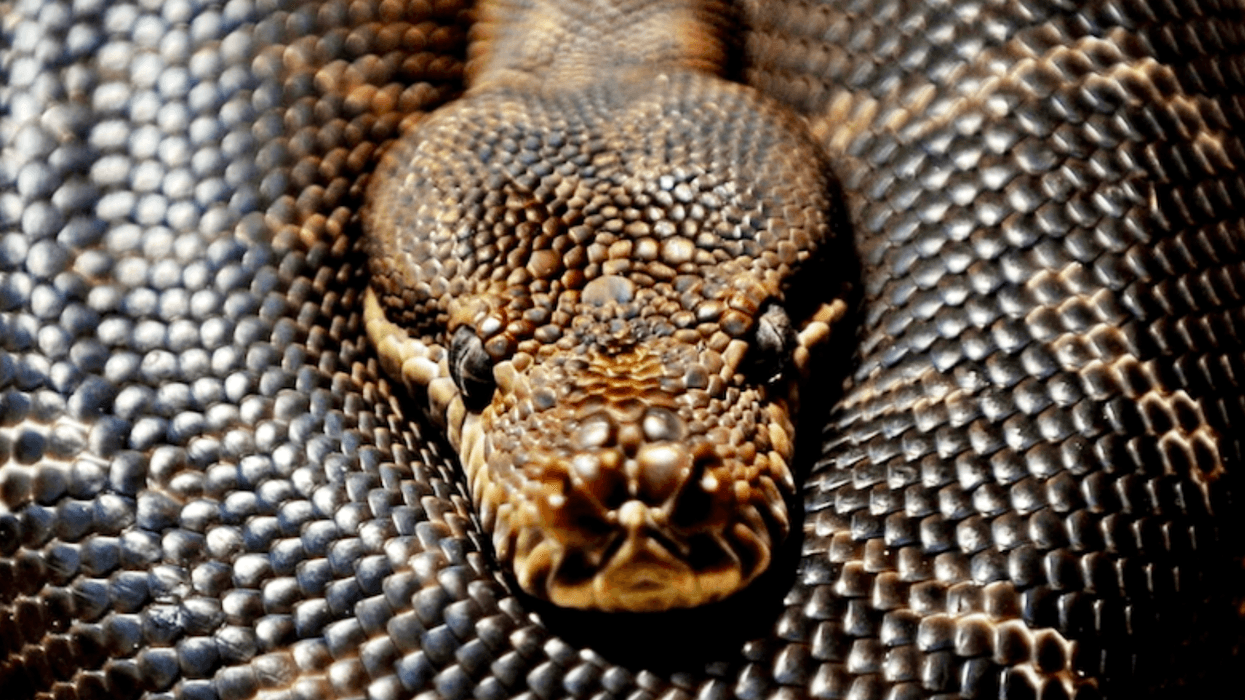Australian doctors find live parasitic worm in woman's brain
