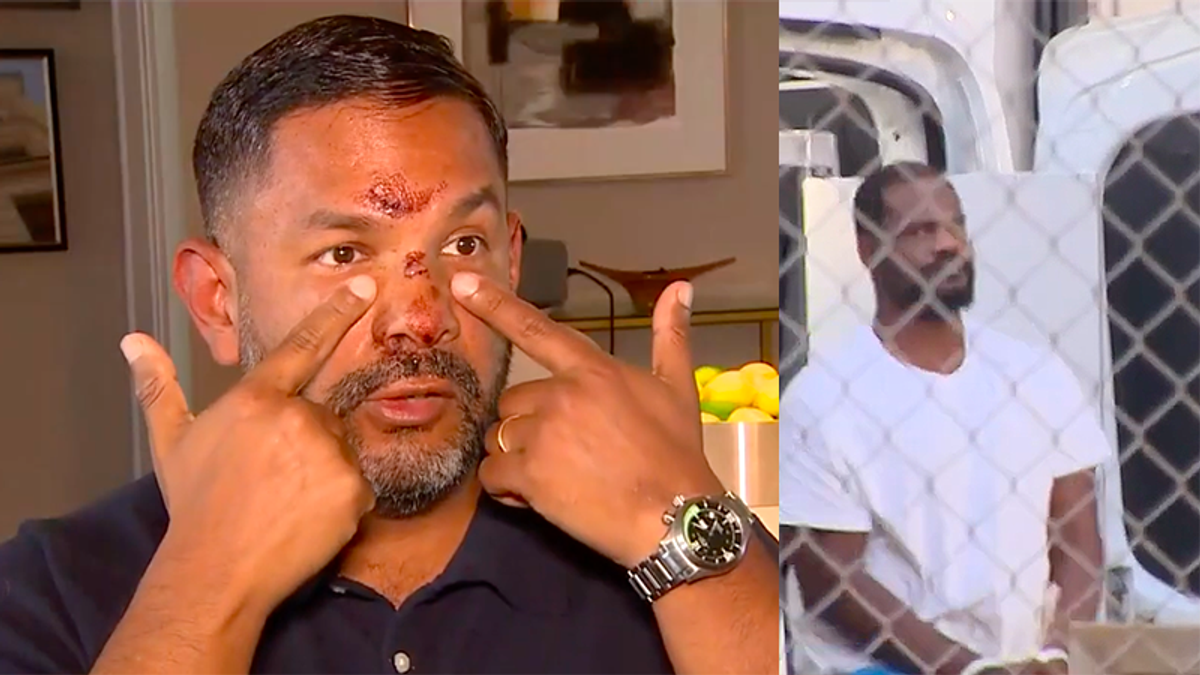 Florida man says he was brutally beaten in front of his own home for being gay