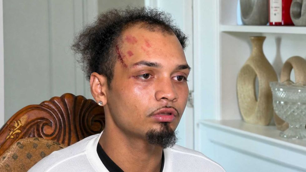 'They wanted to kill me': New York man speaks out after ICE mistakenly beats him