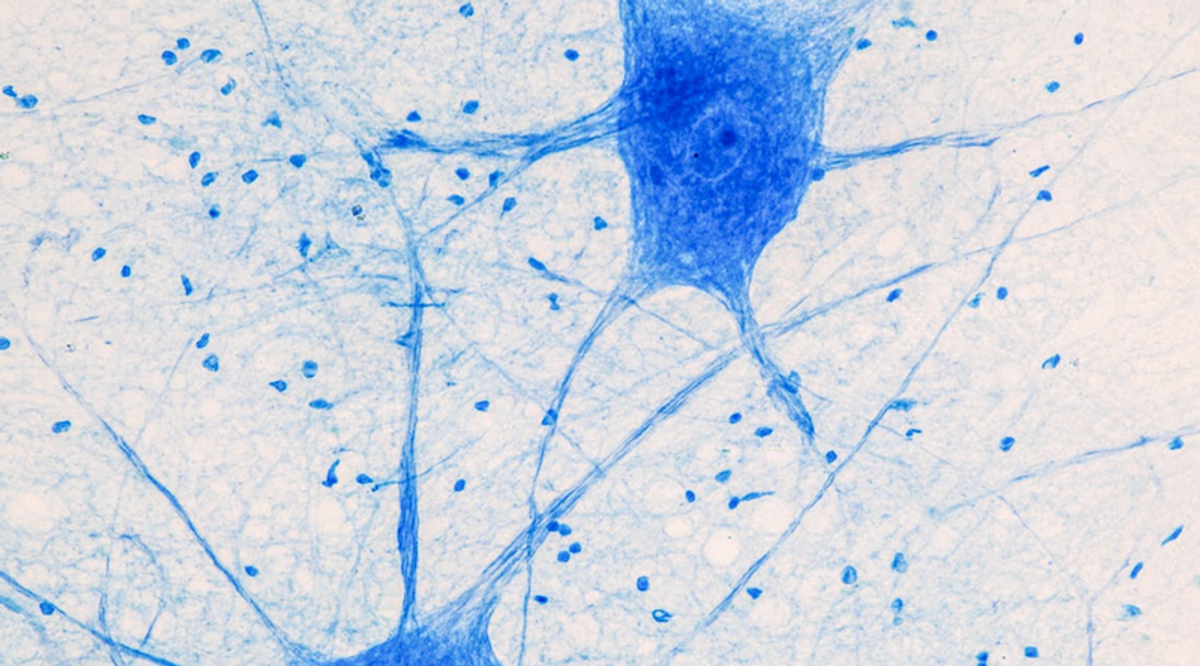 Nanoscopic motor proteins in the brain build the physical structures of memory