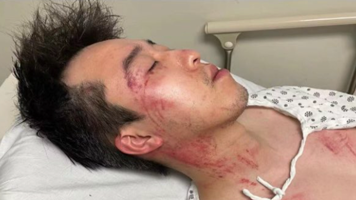 Asian-American man viciously beaten in terrifying encounter caught on video