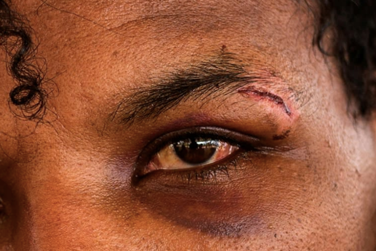 Scam center survivors tell of beatings, abuse in Myanmar
