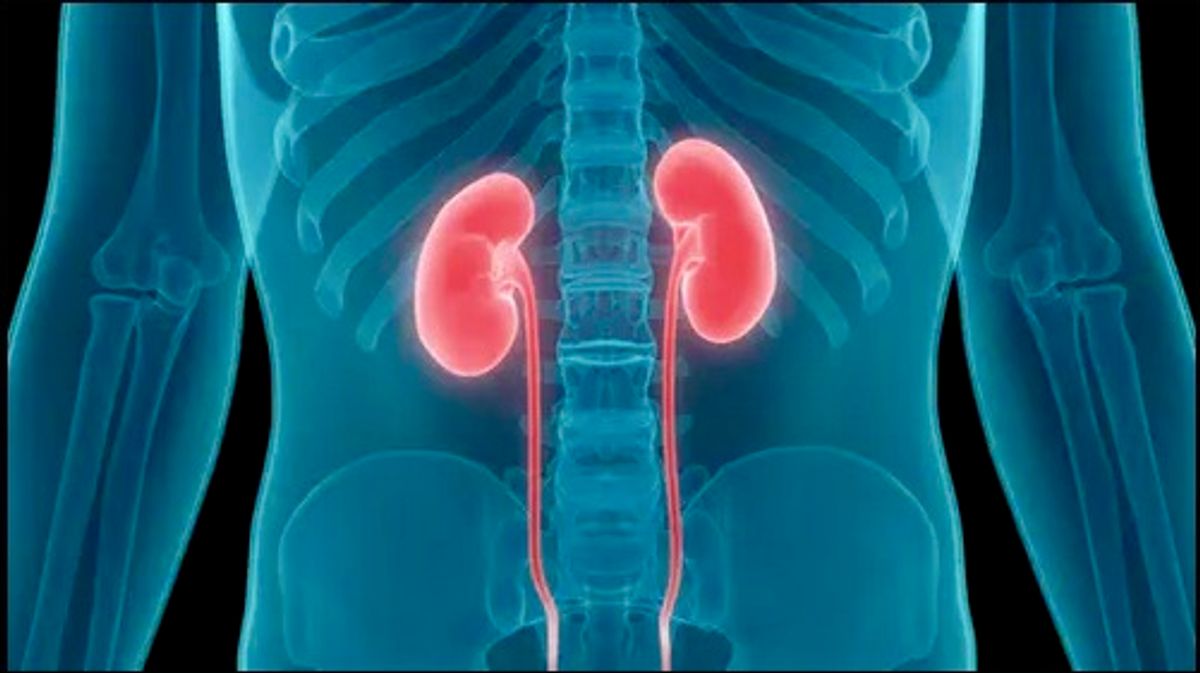Could awake kidney transplants become the norm?