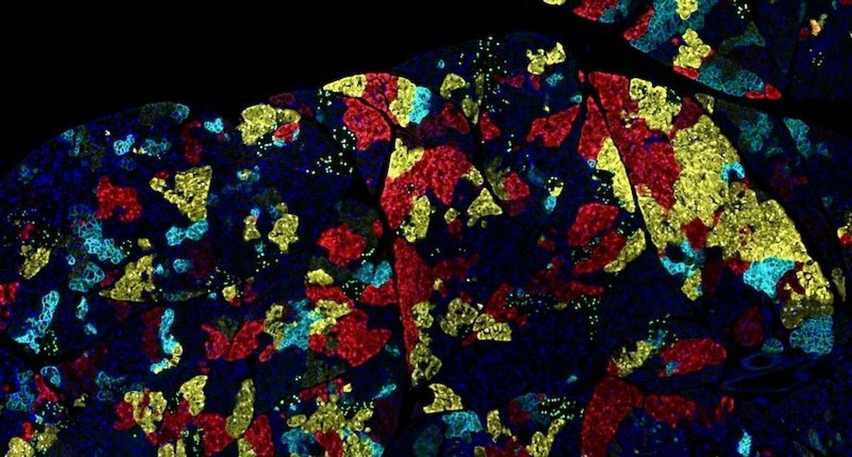 Every cancer is unique – why different cancers require different treatments, and how evolution drives drug resistance