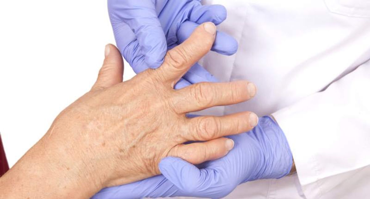 Newly discovered species of bacteria in the microbiome may be a culprit behind rheumatoid arthritis