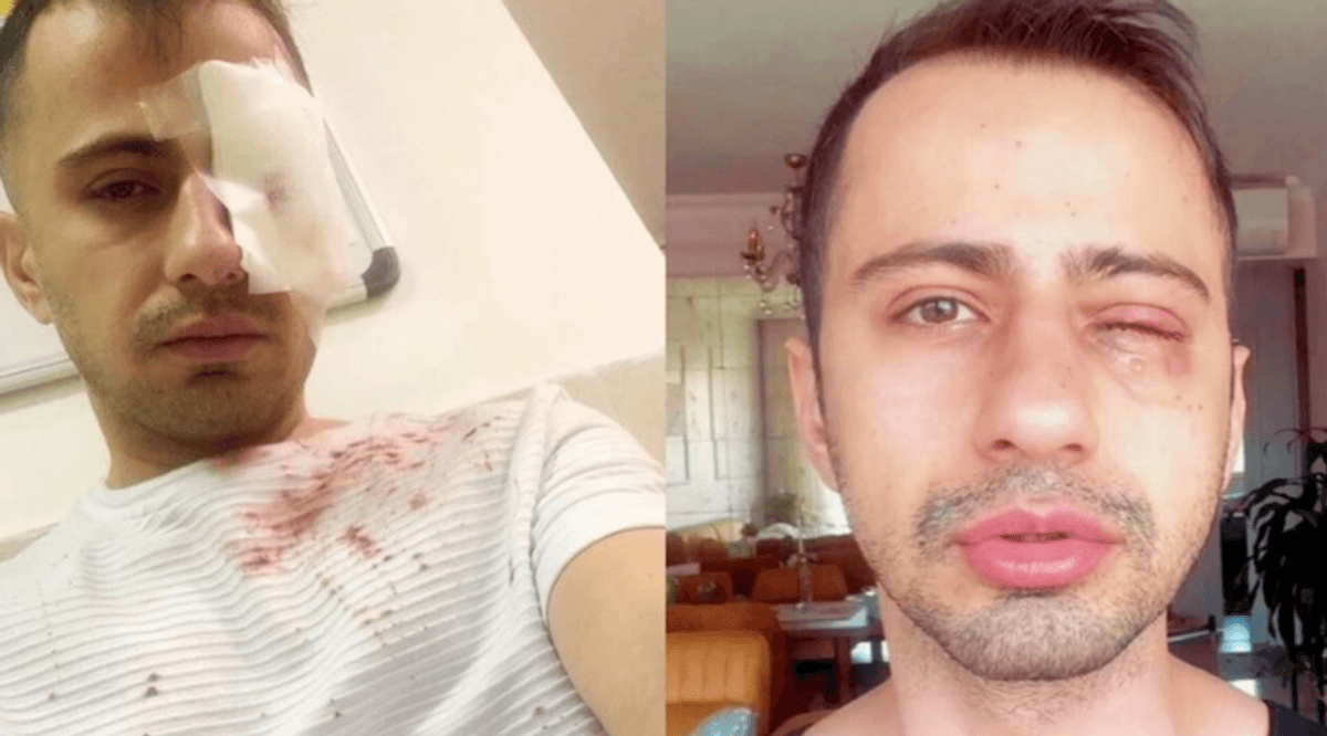 Repression in Iran: 'Whoever targeted my eye knew exactly who I was'