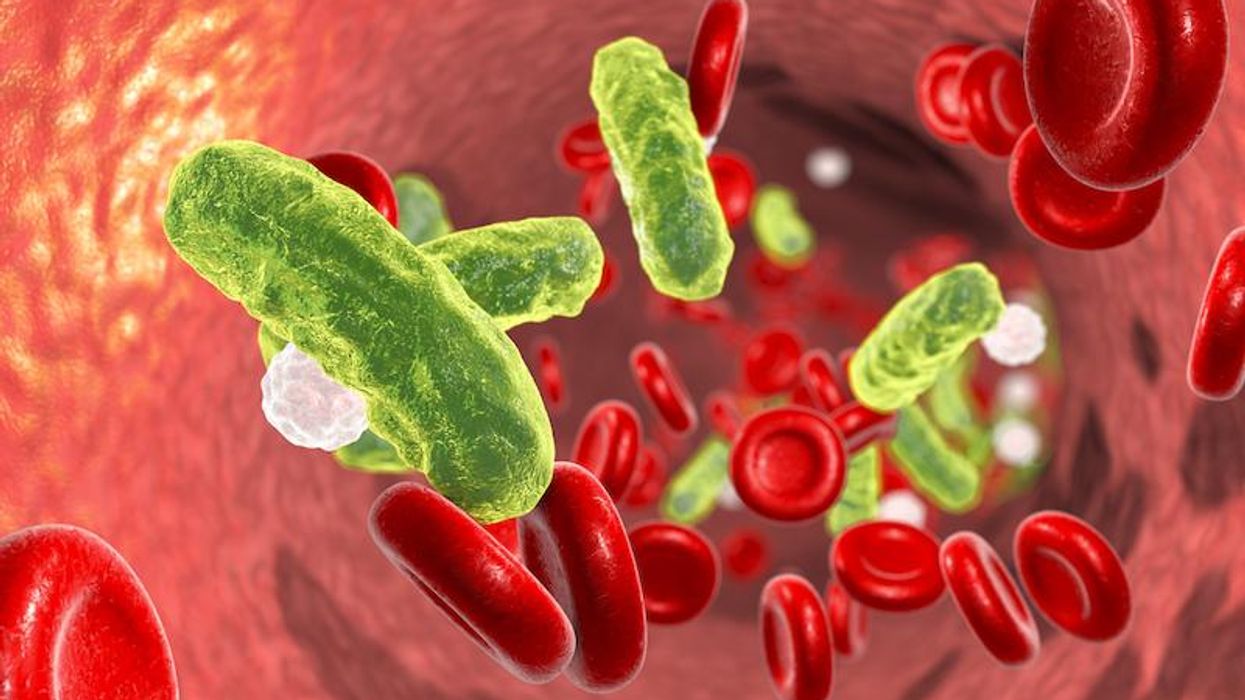 Sepsis is one of the most expensive medical conditions in the world – new research clarifies how it can lead to cell death
