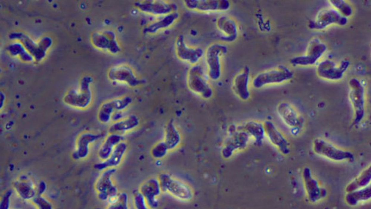 Fatal brain-eating amoeba infection may be linked to Florida tap water used in nasal rinse: Officials