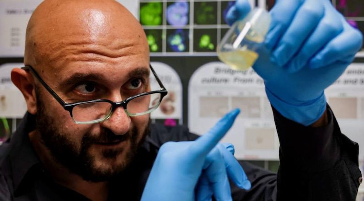 'Synthetic embryo' breakthrough but growing human organs far off