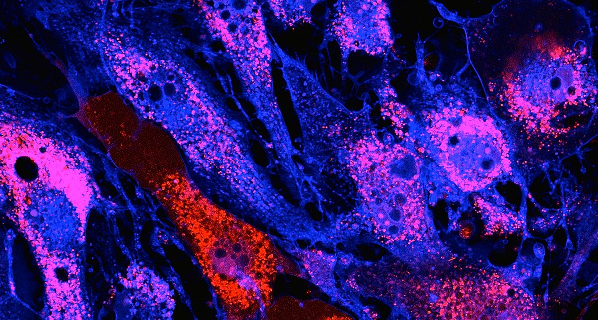 A ‘memory wipe’ for stem cells may be the key to better therapies