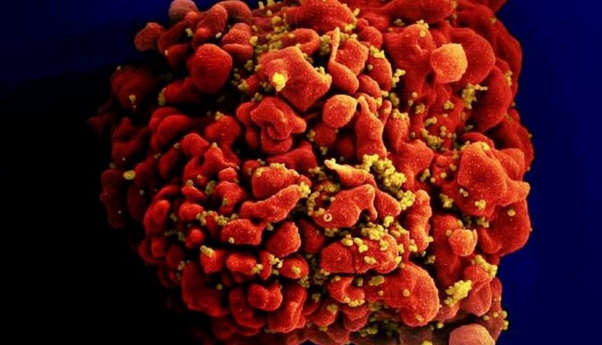 Experimental mRNA vaccine for HIV shows promise in animals