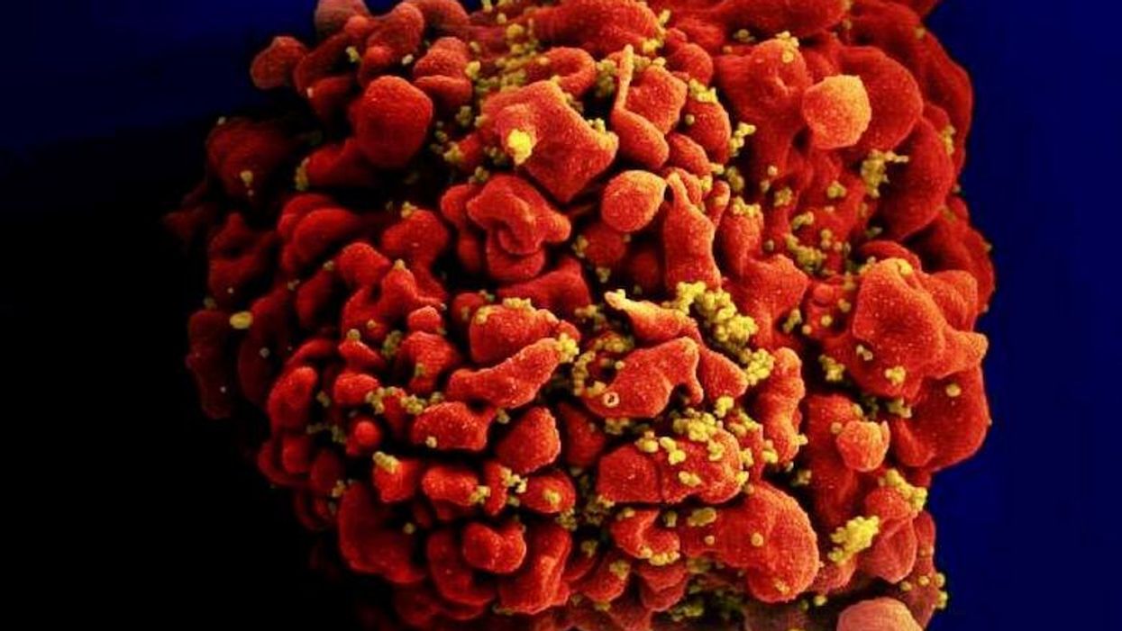 Experimental mRNA vaccine for HIV shows promise in animals
