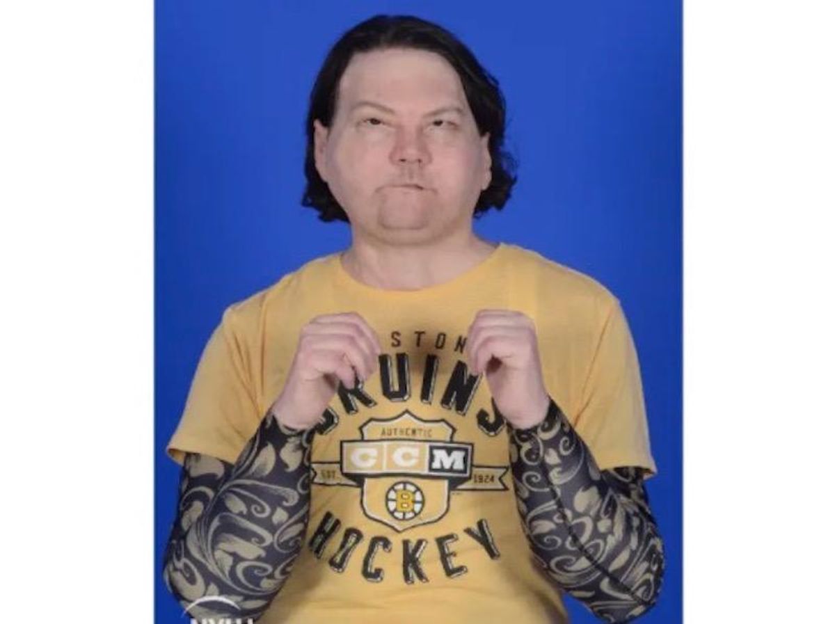 US accident victim gets first double hand and face transplant