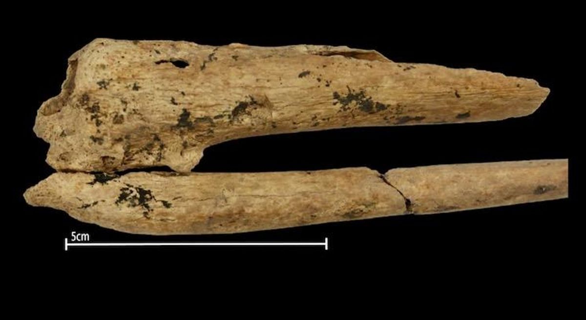 World’s earliest evidence of a successful surgical amputation found in 31,000-year-old grave in Borneo