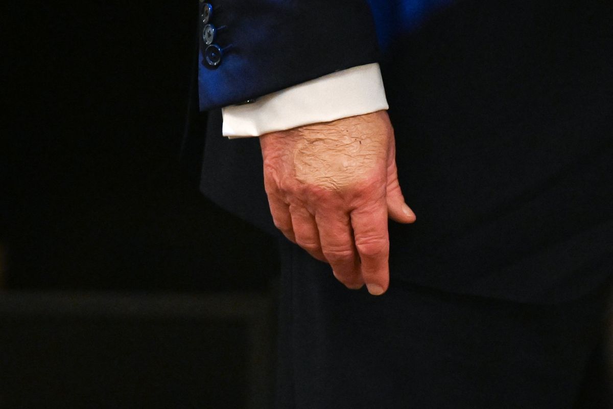 Trump's hand